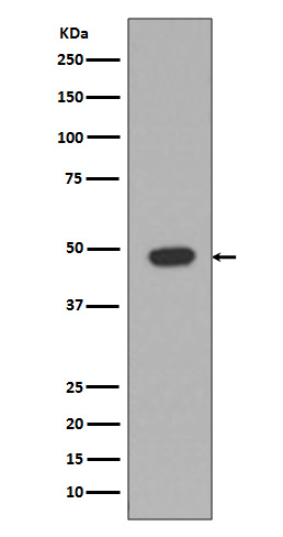 GFAP Rabbit mAb 