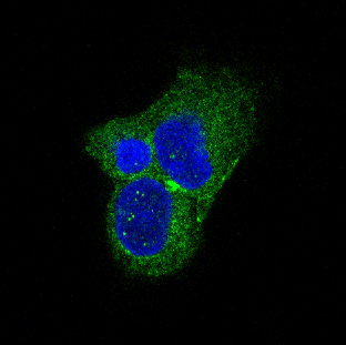 Tyrosine Hydroxylase Rabbit mAb 