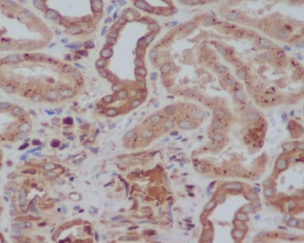 Tyrosine Hydroxylase Rabbit mAb 