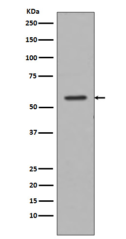 Tyrosine Hydroxylase Rabbit mAb 