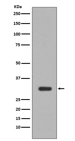 PIM1 Rabbit mAb 