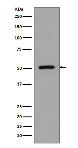 FLI1 Rabbit mAb 