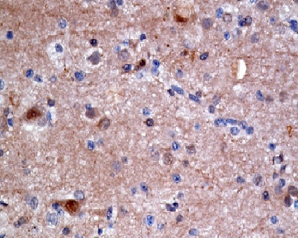 ATP citrate lyase Rabbit mAb 