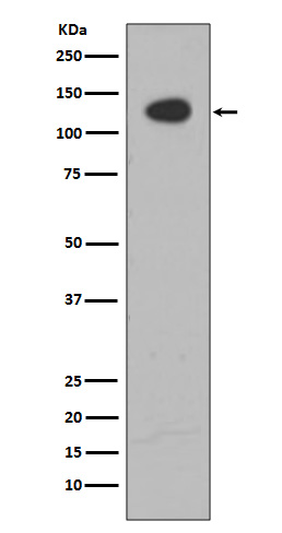 ATP citrate lyase Rabbit mAb 