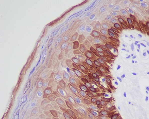 Cytokeratin 16 Rabbit mAb