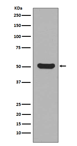 Cytokeratin 16 Rabbit mAb