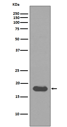 UBE2I Rabbit mAb