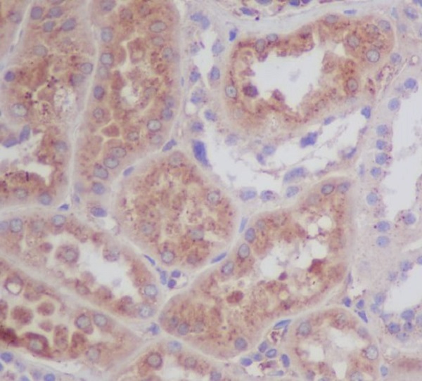 Apolipoprotein E Rabbit mAb