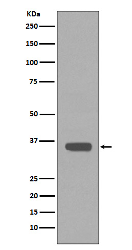 Apolipoprotein E Rabbit mAb