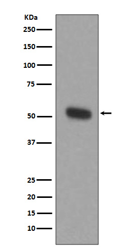 TPH1 Rabbit mAb