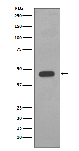 Cytokeratin 14 Rabbit mAb