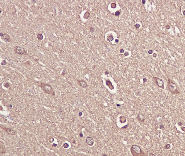 BDNF Rabbit mAb