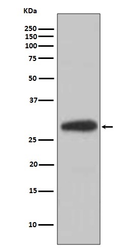 BDNF Rabbit mAb