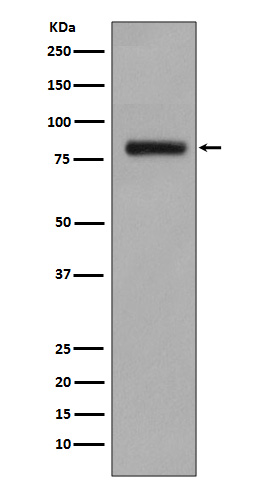 GOLPH2 Rabbit mAb