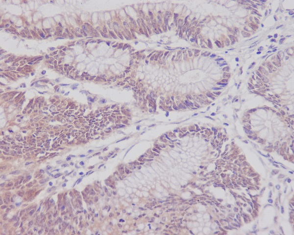 CD3 epsilon Rabbit mAb