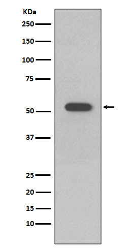 Cytokeratin 10 Rabbit mAb