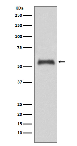 Caspase-8 Rabbit mAb