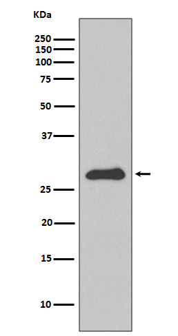 Apolipoprotein A1 Rabbit mAb