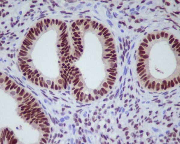 Progesterone Receptor Rabbit mAb