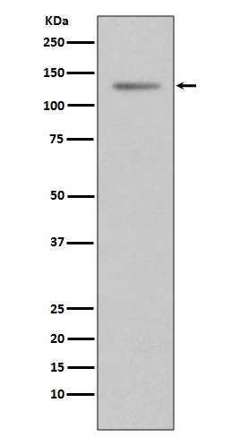 Progesterone Receptor Rabbit mAb