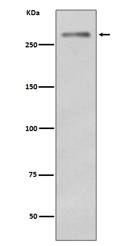 Dysferlin Rabbit mAb
