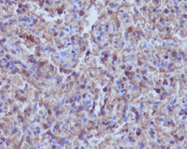 Hemoglobin subunit alpha Rabbit mAb