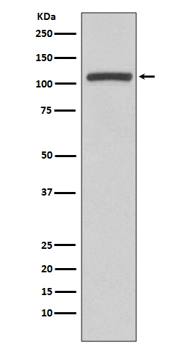 PI3 Kinase p110 beta Rabbit mAb