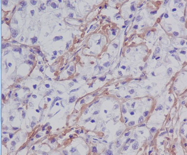 Fibronectin Rabbit mAb