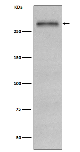 Fibronectin Rabbit mAb