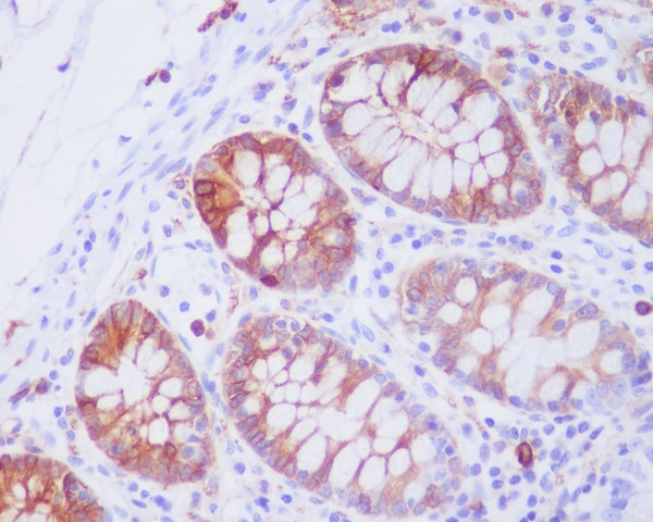 JNK2 Rabbit mAb