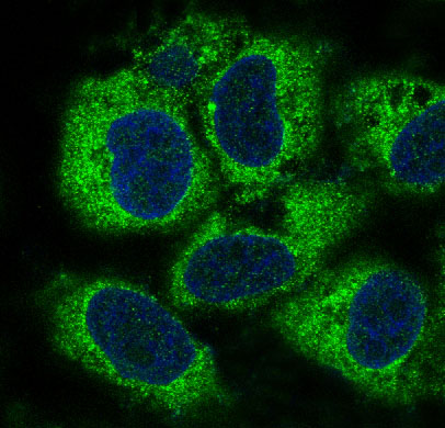 PEBP1 Rabbit mAb