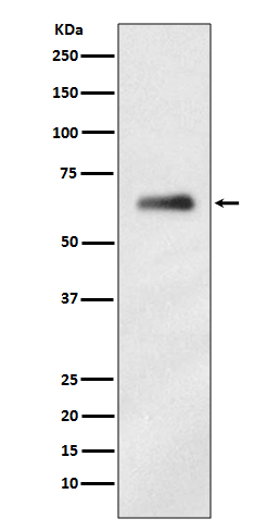 hnRNP K Rabbit mAb