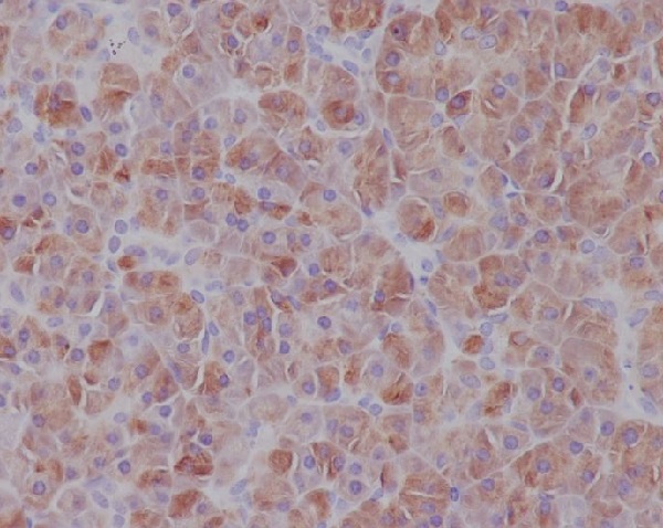 IRF7 Rabbit mAb