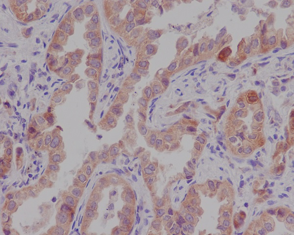 Catenin alpha 1 Rabbit mAb