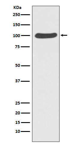 Catenin alpha 1 Rabbit mAb