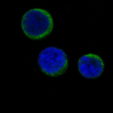 Ferritin Rabbit mAb