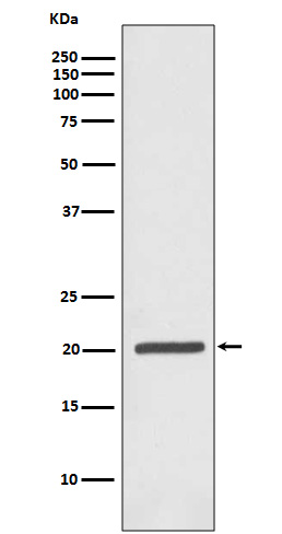 Ferritin Rabbit mAb