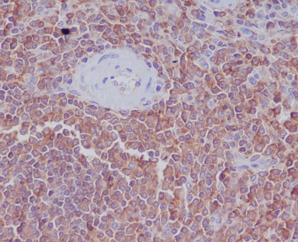 Radixin Rabbit mAb