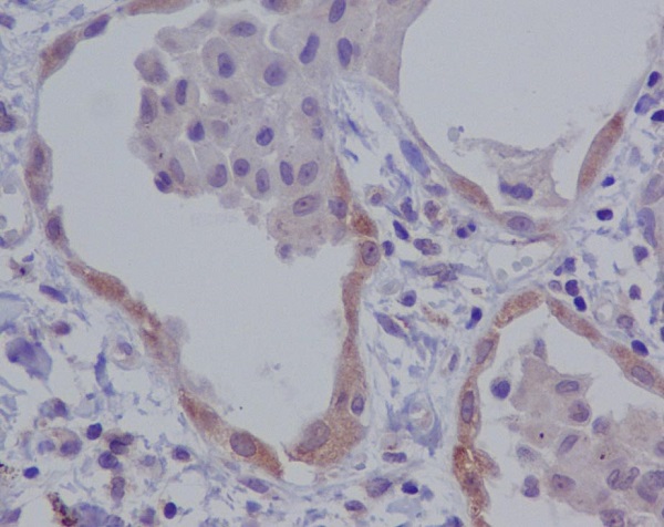 NALP3 Rabbit mAb