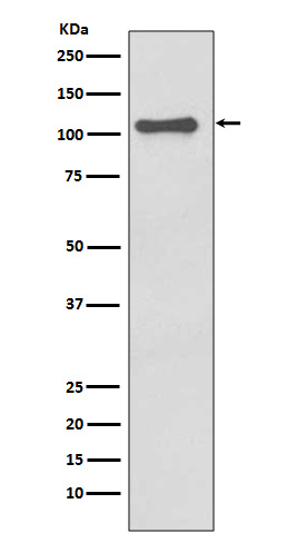 NALP3 Rabbit mAb