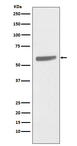 Cytokeratin 5 Rabbit mAb