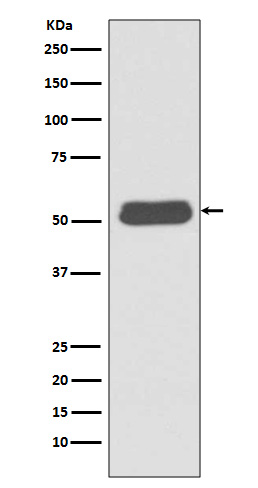 LSP1 Rabbit mAb