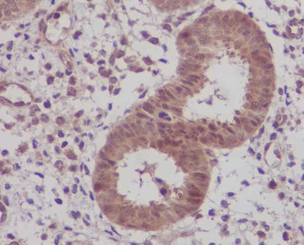 IKB beta Rabbit mAb