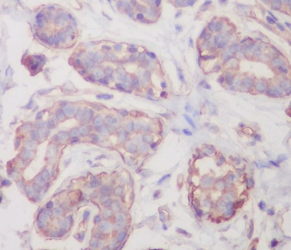 RALBP1 Rabbit mAb