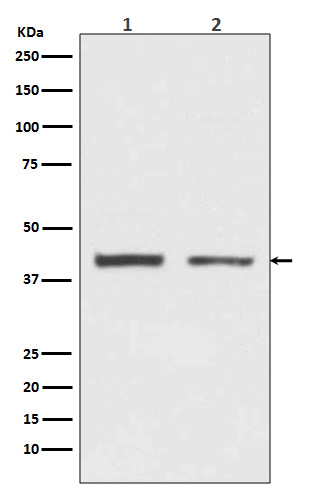 hnRNP C1/C2 Rabbit mAb