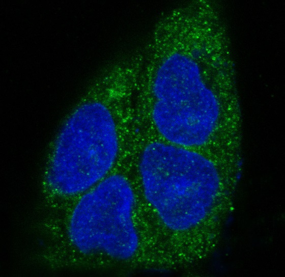 MyD88 Rabbit mAb