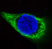 Cytokeratin 14 Rabbit mAb