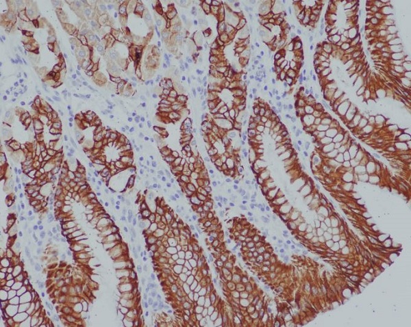 Cytokeratin 14 Rabbit mAb