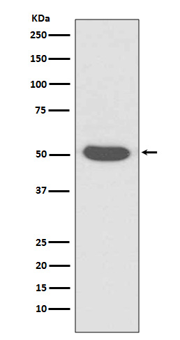 Cytokeratin 14 Rabbit mAb