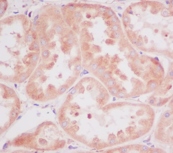 RPS20 Rabbit mAb